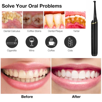 Multifunktions-Elektriske Tand Poler Dental Pletten Plak Remover Tandblegning Rengøring Odontologia Værktøjer Mundhygiejne