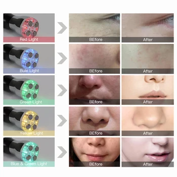 EMS Micro nuværende Hud Foryngelse LED Foton Lys Facial Radio Frekvens Elektroporation at Løfte Huden Massage Skønhed Enhed