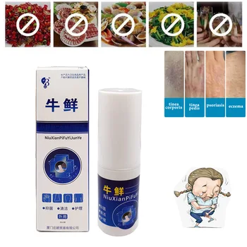 Relief Hud Probelm Salve, Spray Psoriasi Eczma spray Kinesisk medicinsk Hud Ubehageligt Produkt