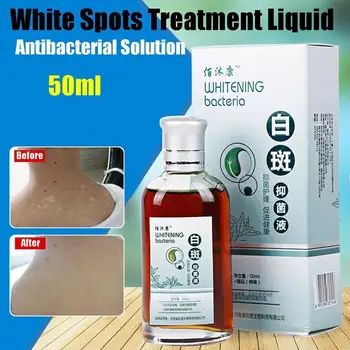 50 ml Bacteriostasis Hvid Plet Sygdom Remover Væske Pigment Melanin Fremme Liniment Vitiligo Leukoplakia Hud Behandling