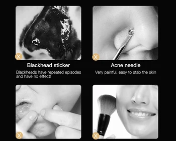 Ultralyd Skrubber Dybt Rensende Ansigt Skrubber Facial Cleansing Skovl At Eksfoliere Huden Skraber Peeling Skønhed Instrument