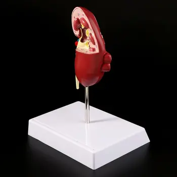 Nyre-Syge Model Anatomiske Anatomi Syge Patologiske Sten Orgel Undervisning Forsyninger L29K