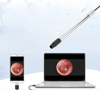 Hals-og ørelæge endoskop oralexam instrument livmoderhalsen elektroniske kolposkop mobiltelefon speculum high-definition kamera